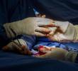 Imagen de referencia de una cirugía de transplante de órganos. FOTO: JULIO CÉSAR ECHEVERRI