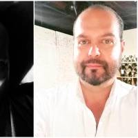 Andrés Bejar necesita una auriculectomía, procedimiento que debe realizarse de manera urgente para evitar que el cáncer se propague a ganglios u otros órganos. FOTOS tomada de Instagram @andreshbejar 