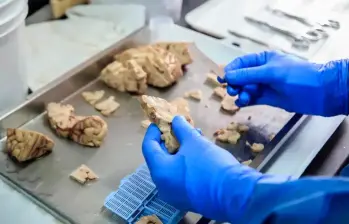 La ciencia a nivel internacional reconoce el trabajo del Grupo de Neurociencias como fundamental para lograr los más grandes avances contra el Alzhéimer en las últimas décadas. FOTO: CAMILO SUÁREZ