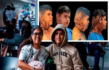 Luis Miguel Collazos fue diagnosticado con neurofibromatosis tipo 1 después de 14 años de ir de hospital en hospital junto a su madre, Margot Montalvo. FOTO: Julio César Herrera