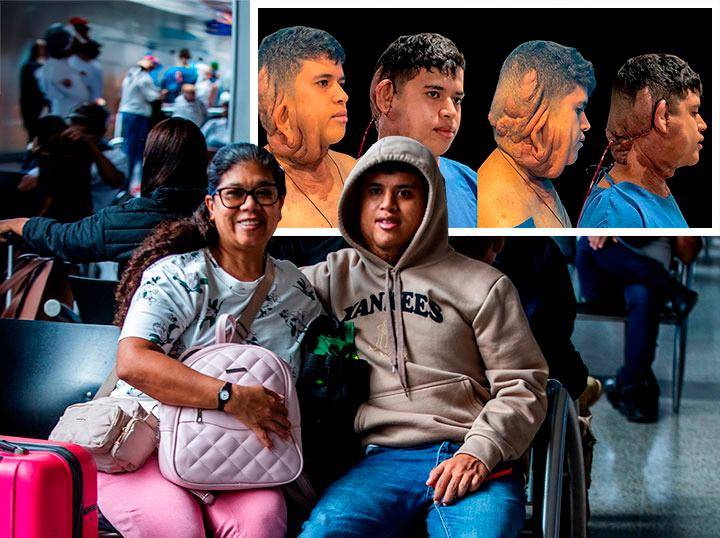 Luis Miguel Collazos fue diagnosticado con neurofibromatosis tipo 1 después de 14 años de ir de hospital en hospital junto a su madre, Margot Montalvo. FOTO: Julio César Herrera