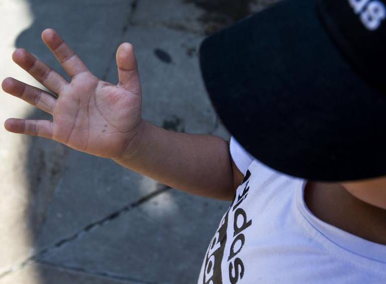 La niña que sufrió los golpes a manos de su padre tuvo que ser incapacitada por 8 días. Foto: Julio César Herrera Echeverri