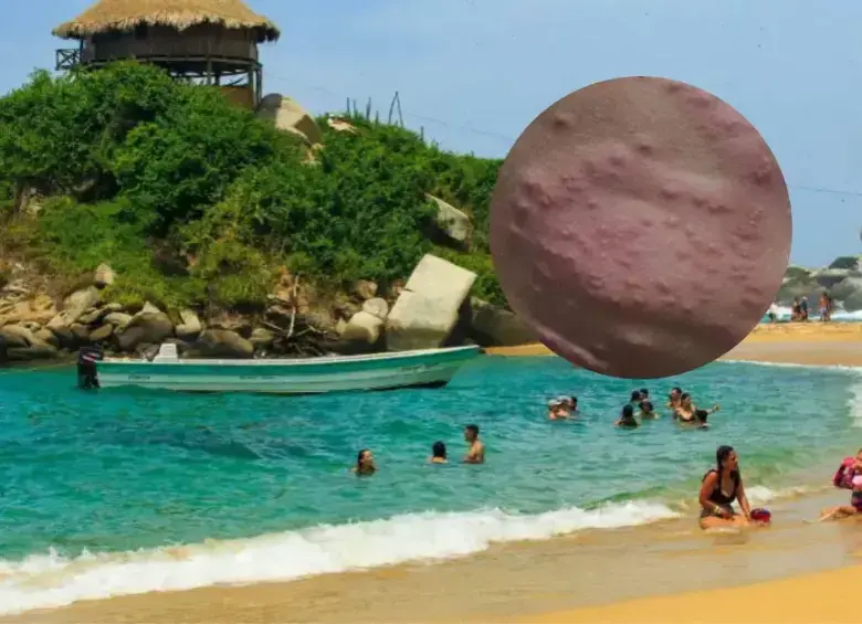 Tras denuncias de brotes en la piel de bañistas, Procuraduría pidió evaluar calidad del agua en 7 playas de Santa Marta