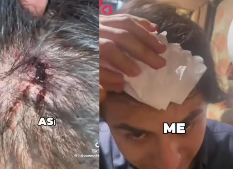 Así fue la herida del joven. Foto: Captura de video.