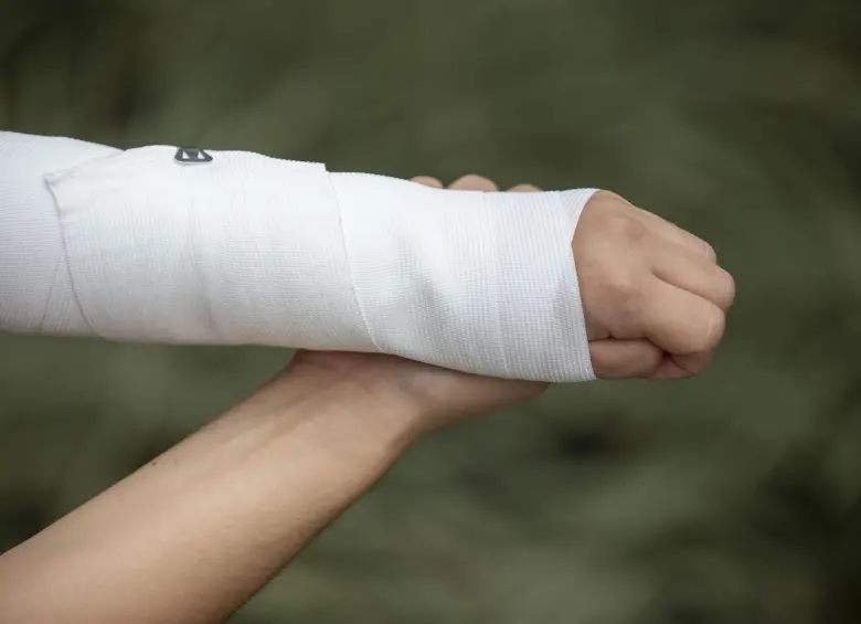 En lo corrido de este año, de los 81 quemados que van en Antioquia, 24 corresponden a menores de edad. FOTO: Edwin Bustamante