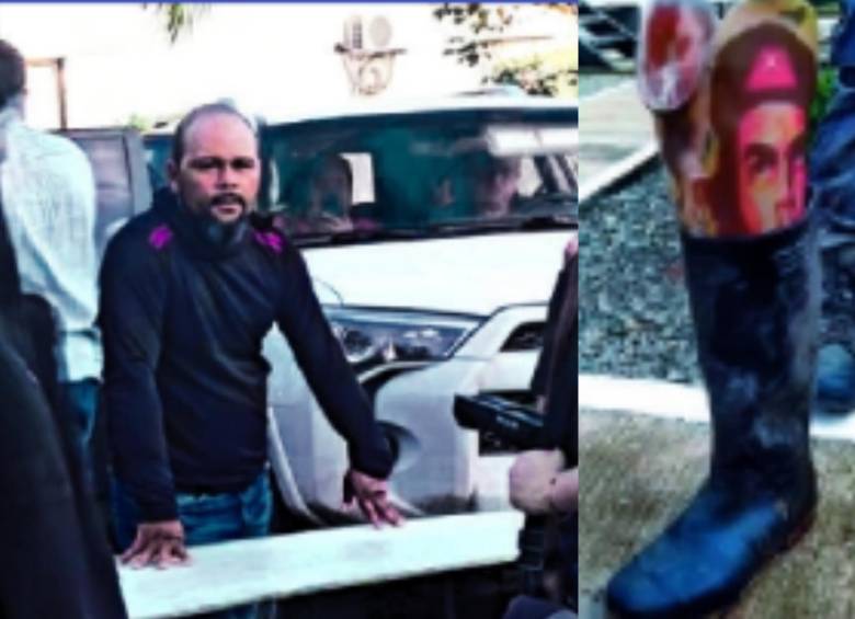 “Ramiro” perdió su extremidad en 2012, en una zona rural de la subregión del San Jorge, en el sur de Córdoba, según datos de la Inteligencia Militar. En la foto se ve su deformidad en la mano izquierda. FOTOS: CORTESÍA.