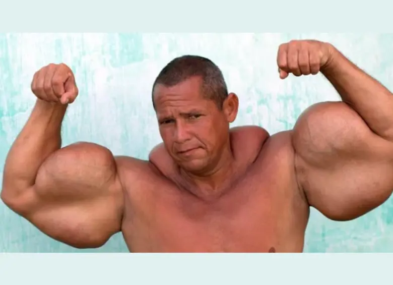 ¿Qué se sabe de la muerte de Arlindo de Souza, conocido como el “Popeye brasileño”? FOTO: Captura de video - Truly - B TV Barcroft TV