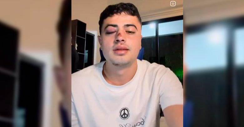 El joven contó el hecho en su cuenta de Instagram y pidió ayuda para acceder a las cámaras que permitan identificar al agresor. IMAGEN TOMADA DE INSTAGRAM