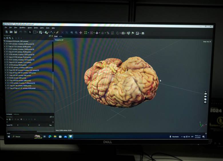 El Neurobanco del Grupo de Neurociencias de Antioquia es un pilar de la investigación sobre enfermedades neurodegenerativas en América Latina. FOTO CAMILO SUÁREZ