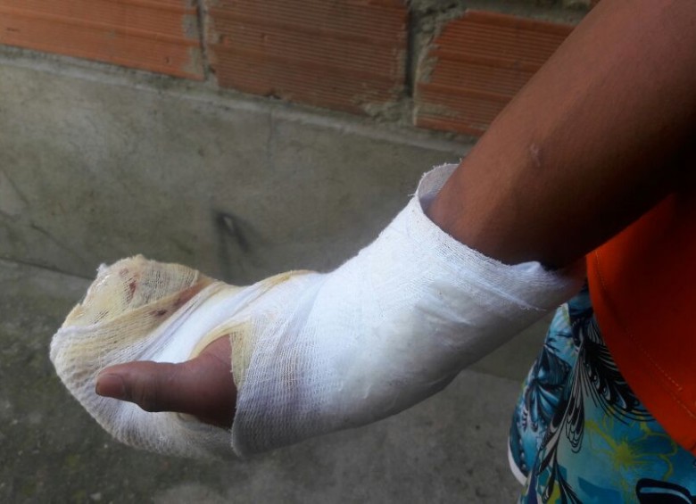11 menores han resultado lesionados en Antioquia por manipulación de pólvora. FOTO ARCHIVO EL COLOMBIANO