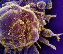 La célula humana está coloreada en morado y, en amarillo, las partículas víricas. Está hecha gracias a un microscopio electrónico de barrido. FOTO Instituto Nacional de Alergias y Enfermedades Infecciosas (NIAID, en inglés) de Estados Unidos .