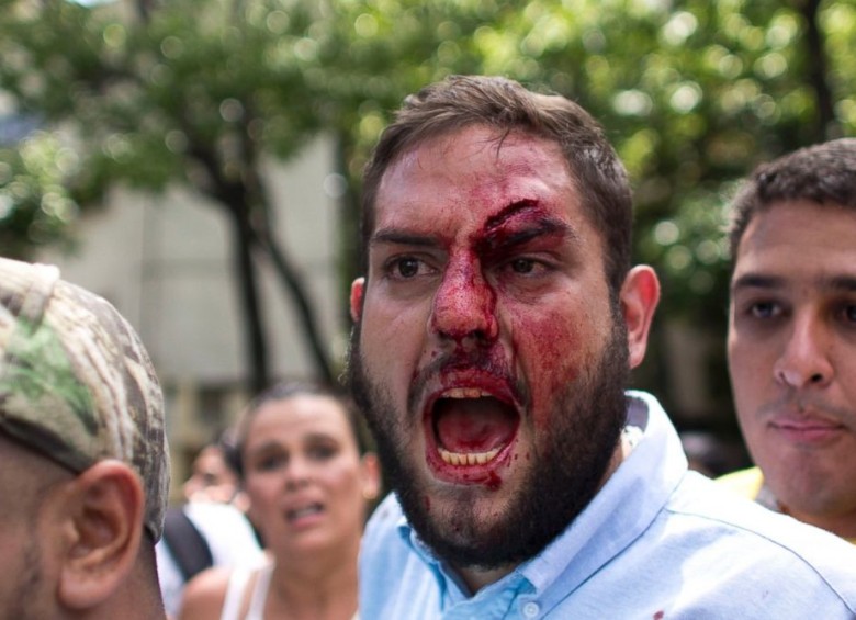 “La dictadura puede estar armada, pero no podrá contra el pueblo”: Opositor venezolano