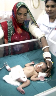 Reuters La bebé se encuentra en cuidados intensivos por su nacimiento prematuro.
