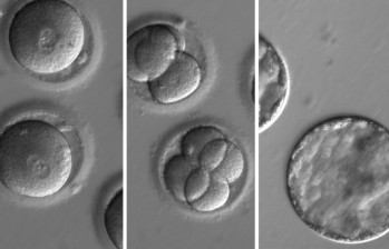 SEcuencia que muestra el desarrollo de embriones luego de la co-inyección de una enzima correctora del gen y espermatozoides de un donante con la mutación. Foto cortesía OHSU