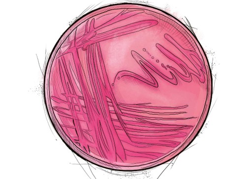 Acinetobacter baumannii. La enfermedad producida por esta bacteria resistente a la mayoría de fármacos puede causar neumonía severa e infecciones del tracto urinario. Ilustraciones: Ricardo Macía Lalinde. 