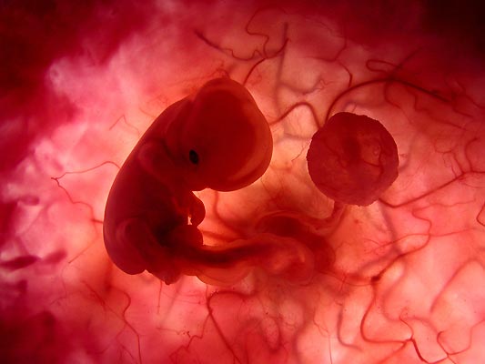En Colombia se puede abortar en los casos en que haya riesgo para la vida de la madre, malformación fetal incompatible con la vida, violación o incesto. FOTO Tomada de National Geographic