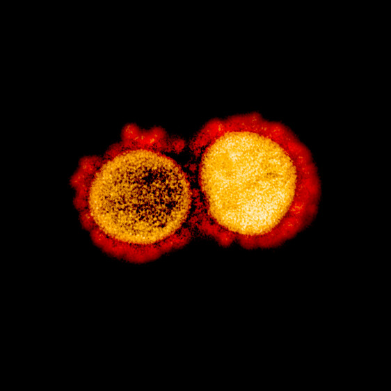 En estas dos fotos se observan partículas del virus vistas con un microscopio electrónico de transmisión. En el exterior se ven las “llaves” que usa el coronavirus para unirse a la “cerradura”’ que está en algunas de en las células y así poder infectarlas. FOTO Instituto Nacional de Alergias y Enfermedades Infecciosas (NIAID, en inglés) de Estados Unidos .