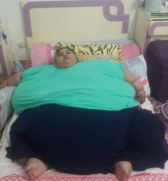 As Fue Como La Mujer M S Obesa Del Mundo Perdi Kilos