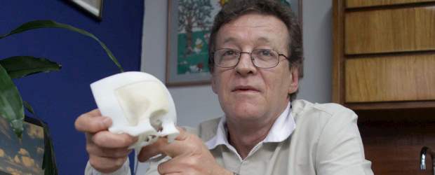 Implantes craneales, avance local | Robinson Saenz | El médico Alejandro Gómez Rodríguez, gerente de la firma DME-3D, muestra los implantes desarrollados localmente, que reducen costos y tiempo en las cirugías de reconstrucción de cráneo.