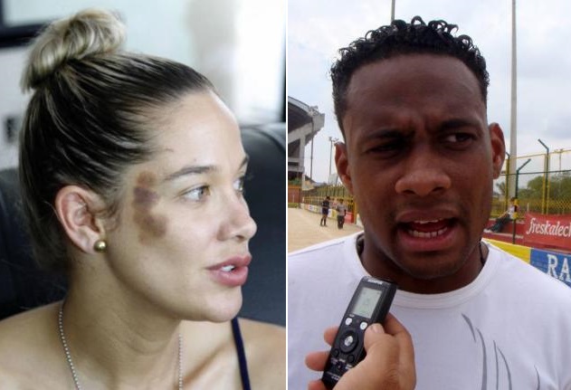 Investigan agresión de exjugador Luis Yanes contra su expareja la expatinadora santandereana Ana María Rodríguez Sanabria . FOTO COLPRENSA Investigan agresión de exjugador Luis Yanes contra su expareja la expatinadora santandereana Ana María Rodríguez Sanabria . FOTO COLPRENSA