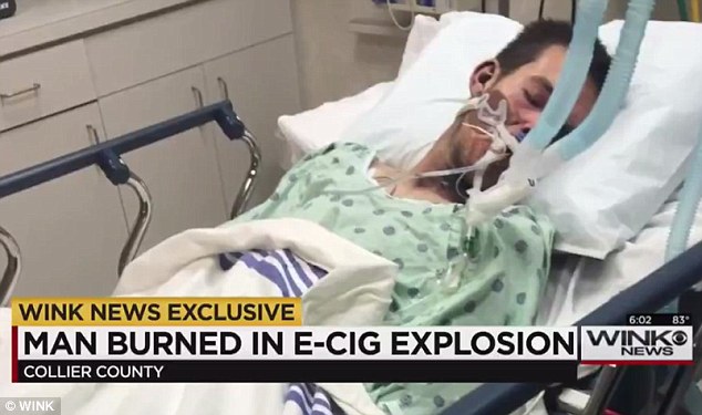 El estadounidense de 21 años se encuentra en coma luego de que un cigarrillo electrónico le explotó en la boca. FOTO WINK