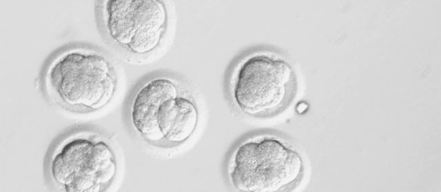Paso gigante de la ciencia hacia la clonación de órganos humanos | Esta imagen, proporcionada por la Universidad de Ciencia y Salud de Oregon, muestra el desarrollo de los embriones humanos clonados. Foto AP