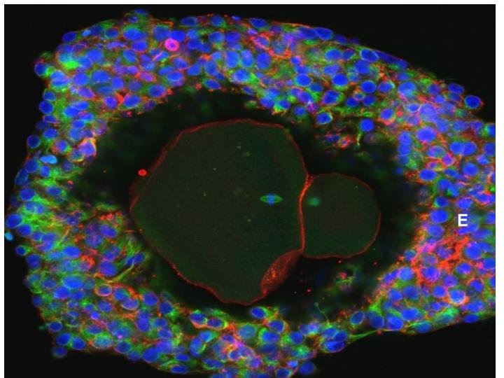 Imagen magnificada de un óvulo madurado en laboratorio. Foto David Albertini