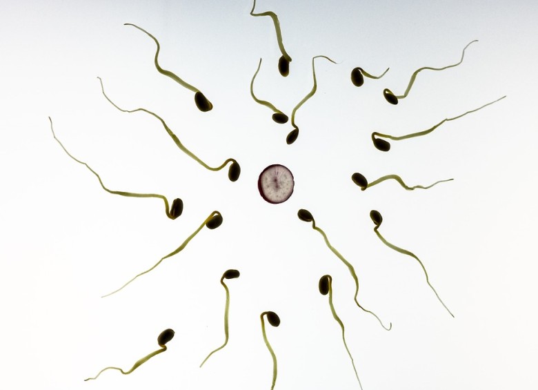 El ruido contribuye al descenso de los espermatozoides y afecta la fertilidad. Foto Pixabay
