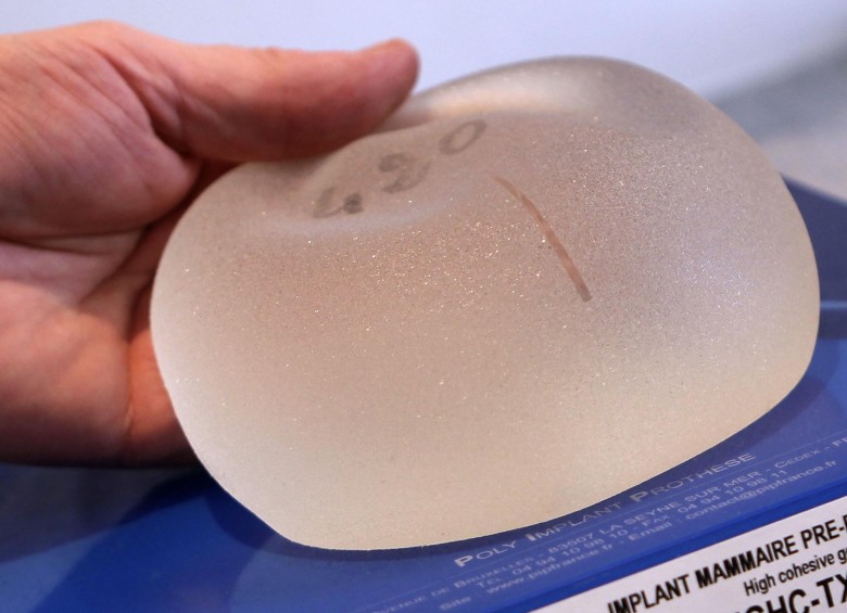 Jean-Claude Mas es el fundador de la empresa que fabricaba y comercializaba los implantes mamarios fraudulentos PIP. FOTO AP