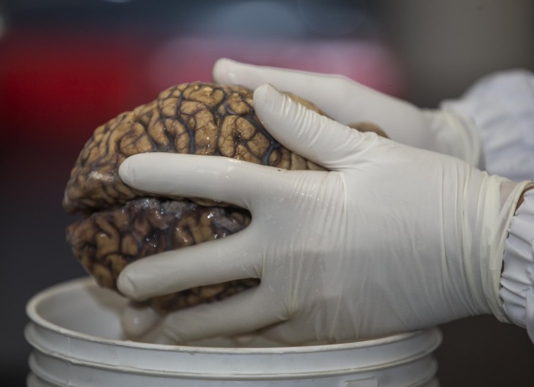 El neurobanco no ha sido solo una colección de cerebros, incluso antes de eso se requería la toma de muestras de sangre para la obtención de ADN. Se ubica en el edificio SIU de la Universidad de Antioquia. FOTO: Julio Herrera