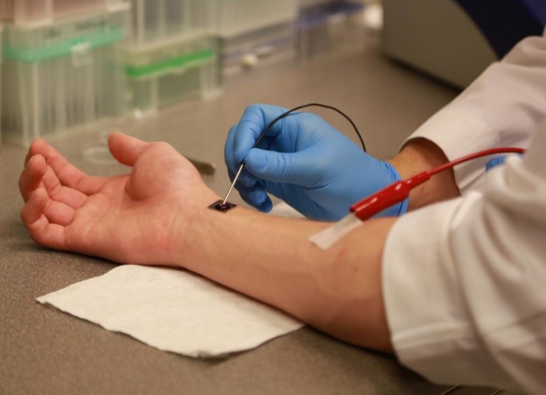 La técnica regenerativa con el nanochip aplicada en el brazo de una persona, en ensayos. Foto Ohio State University
