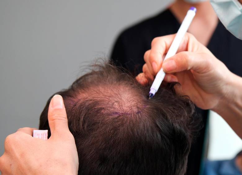 La innovación en la medicina ha mejorado las cirugías estéticas. FOTOSstock