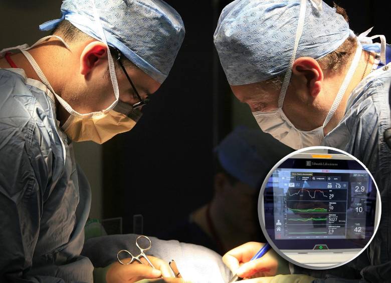 Se estima que 11.600 cirugías al año podrían beneficiarse de esta IA que anticipa caídas de presión arterial. FOTO Getty/cortesía