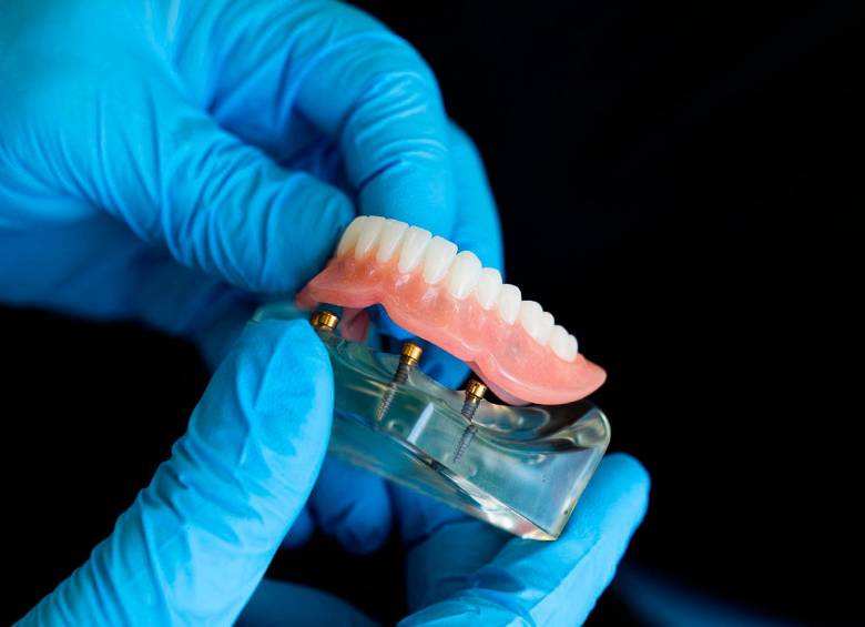 Lo más importante es adoptar desde la niñez excelentes hábitos de limpieza. La caries y la enfermedad periodontal (en las encías) son las principales causas de pérdida dental. FOTO SSTOCK.