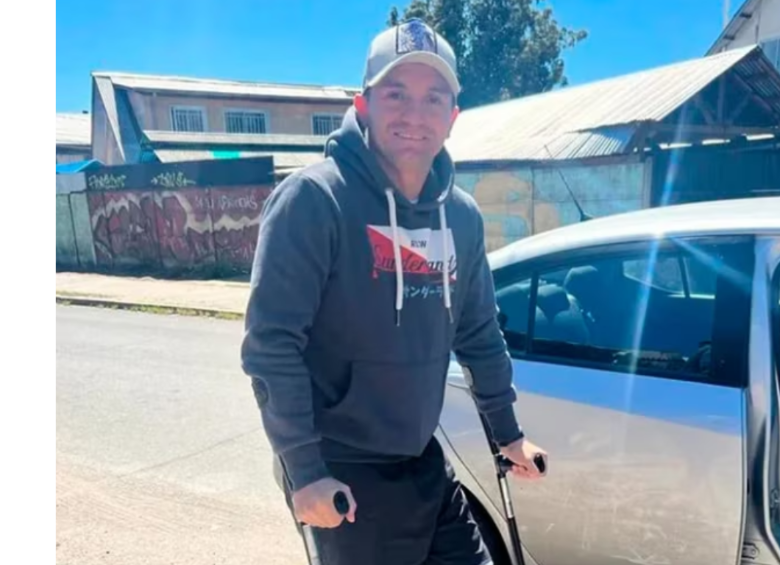 Jorge Alarcón, el trapecista chileno, está ahora en proceso de recuperación. FOTO: REDES SOCIALES
