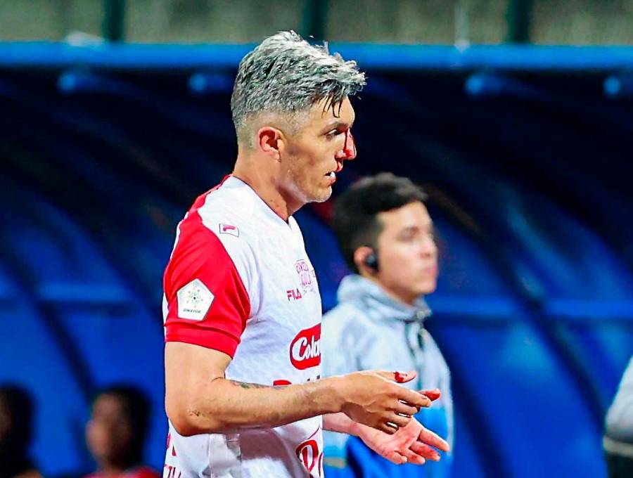 Daniel Torres en el momento que empezó a sangrar tras recibir un monedazo en el rostro, lanzado desde la tribuna occidental del estadio de Ditaires en el duelo entre DIM y Santa Fe. FOTO MANUEL SALDARRIAGA