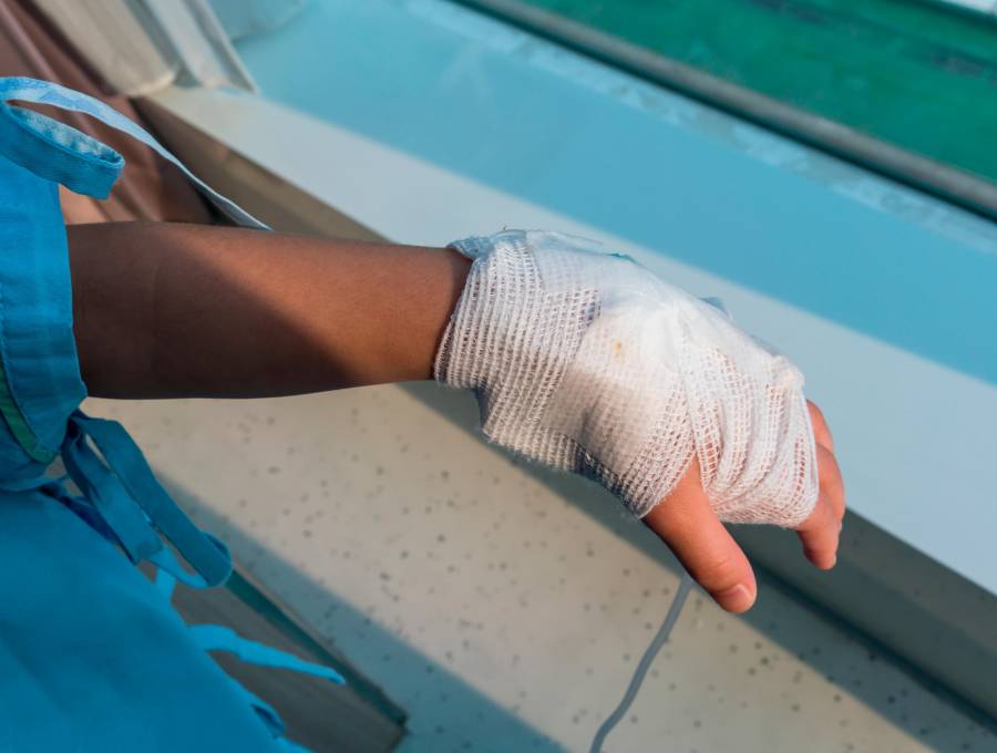 Las manos son la extremidad más afectada por la manipulación de pólvora en Antioquia, con 13 casos. FOTO: GETTY