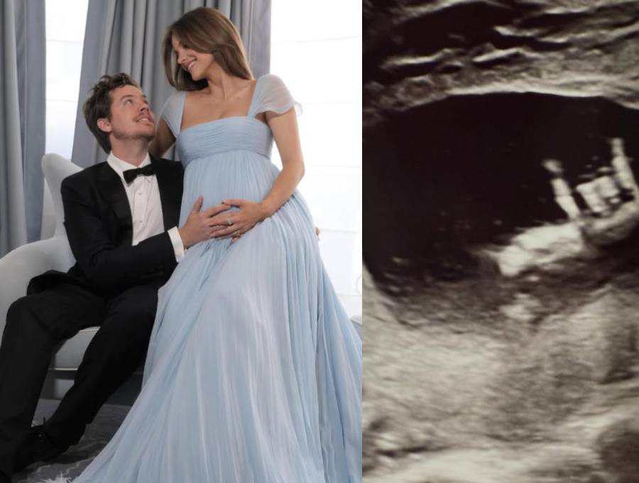Barbara Palvin y Dylan Sprouse sorprendieron en Cannes 2026 al revelar que se convertirán en padres por primera vez. FOTO: Redes sociales de Barbara Palvin y Dylan Sprouse.