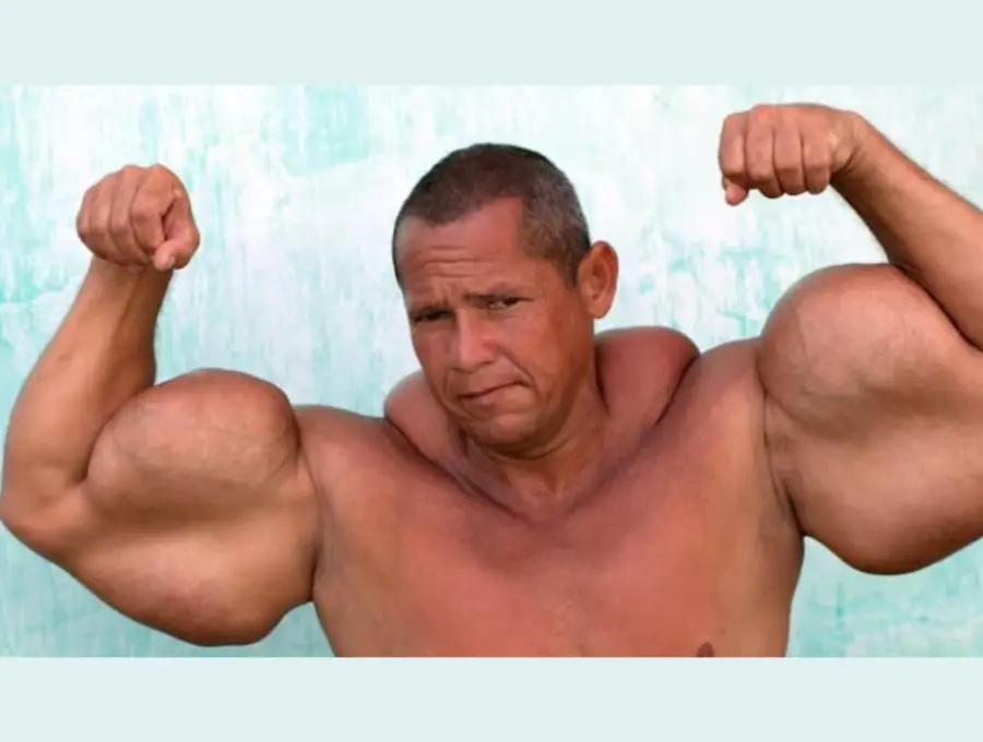 ¿Qué se sabe de la muerte de Arlindo de Souza, conocido como el “Popeye brasileño”? FOTO: Captura de video <i>- Truly - B TV Barcroft TV</i>