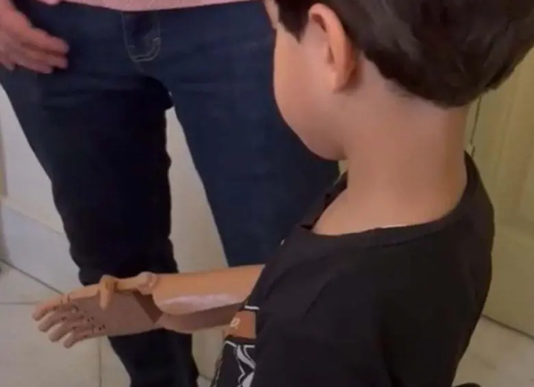 La historia de una ONG que entrega prótesis impresas en 3D a niños víctimas de bombardeos en Gaza
