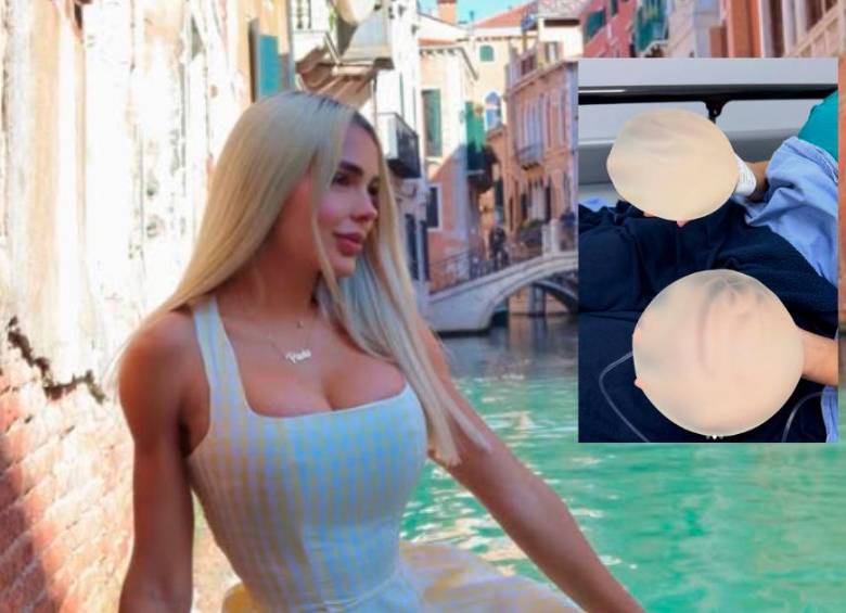 Paola Usme sorprendió a sus seguidores: se retiró los implantes