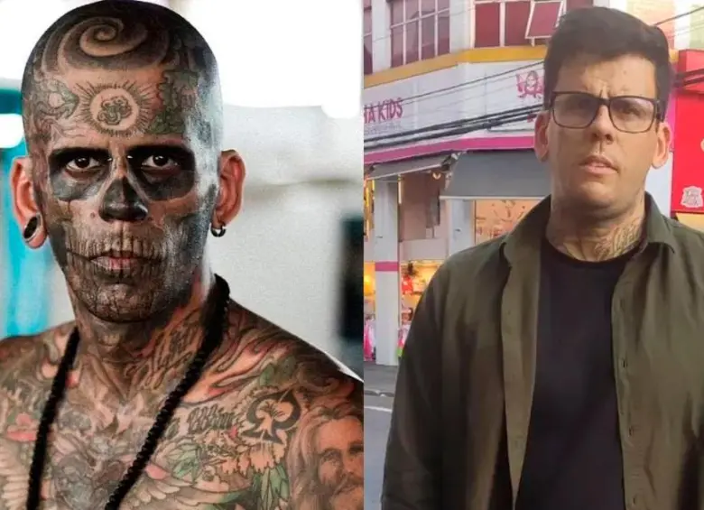 ¡Qué cambio! Hombre más tatuado de Brasil ya no tiene tatuajes en la cara