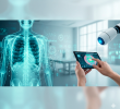 La patente concedida a Indigo Technologies protege un sistema de inteligencia artificial para analizar tumores pulmonares mediante tomografías. FOTO CORTESÍA INDIGO.