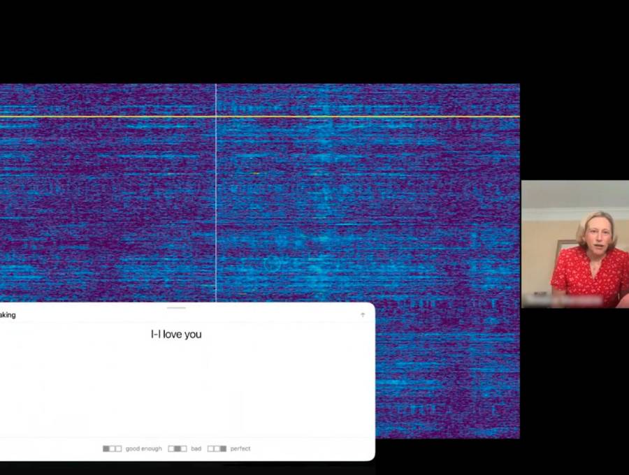 En este experimento se transmitieron los pensamientos del paciente quien le dijo a su esposa: “Te amo”. FOTO tomada de X @neuralink