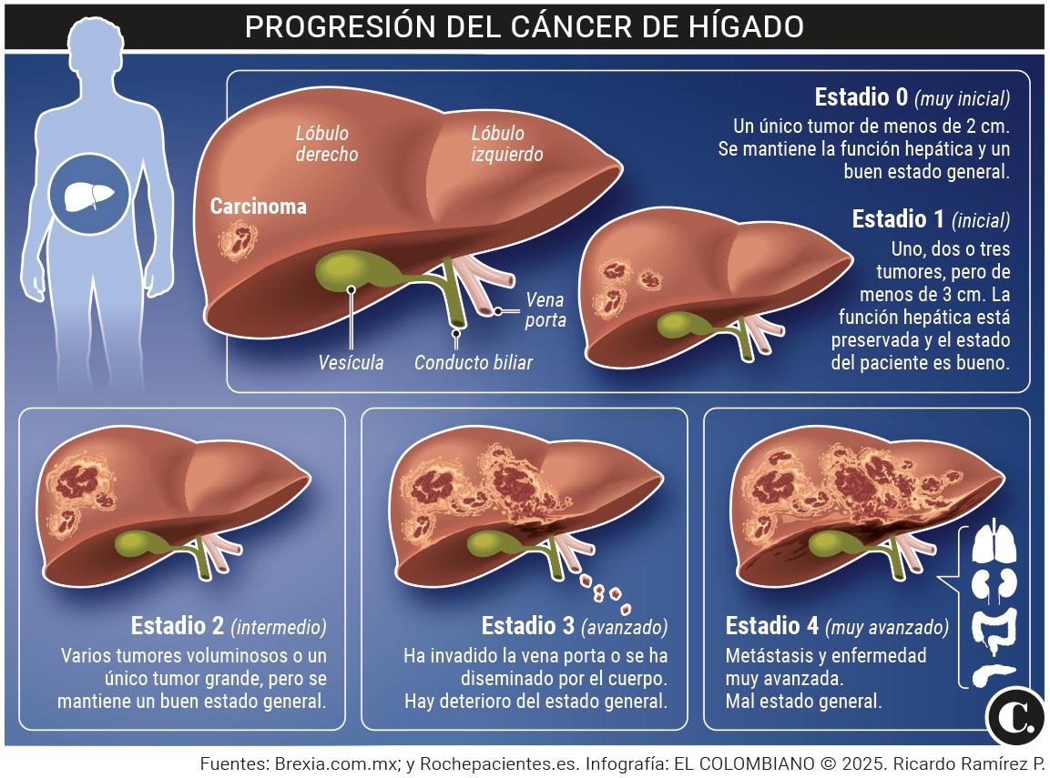 InfogrÃ¡fico