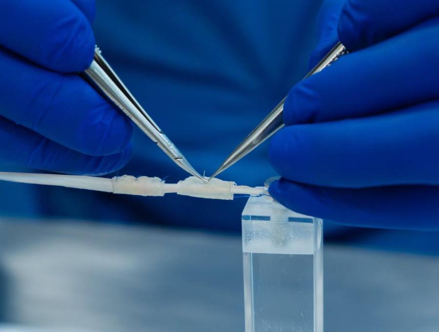 El neurotubo bioabsorbible busca reemplazar los injertos en lesiones de nervios periféricos. FOTO cortesía Ruta n