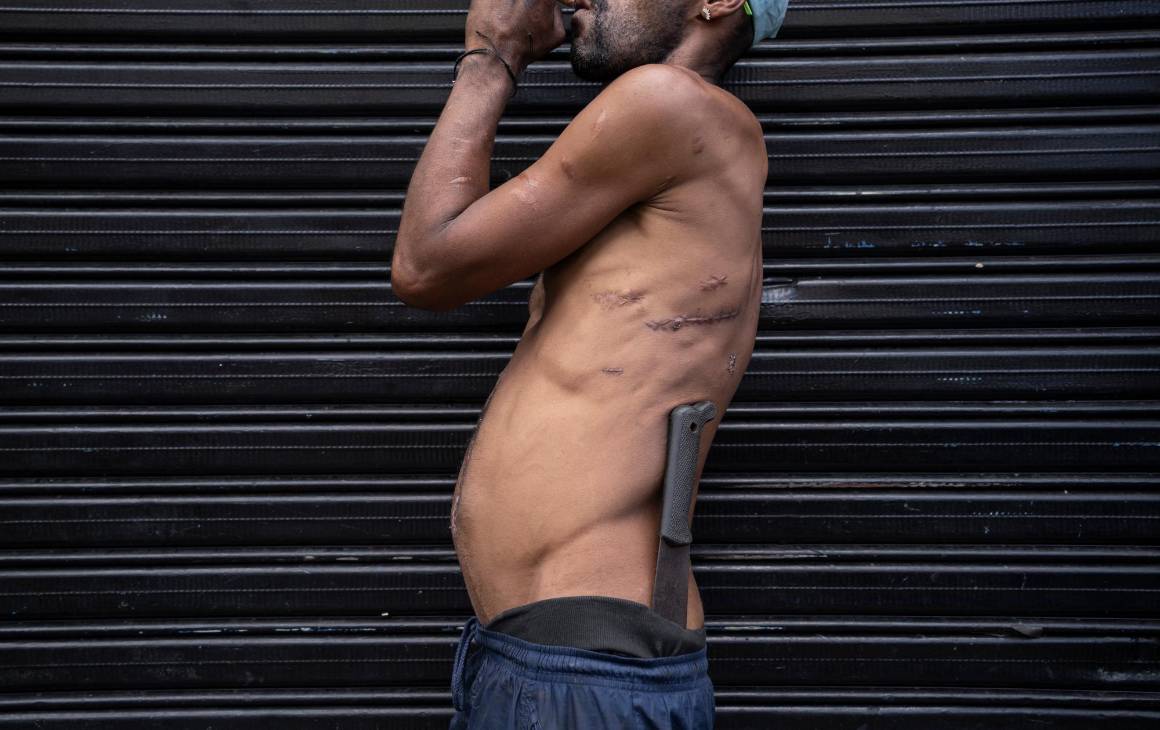 Frankenstein no es un monstruo de ciencia ficción, sino un hombre de la calle cosido a puñaladas y marcado por la vida en las calles del Bronx de Medellín. Ospina une las piezas rotas de la humanidad en esta imagen descarnada.