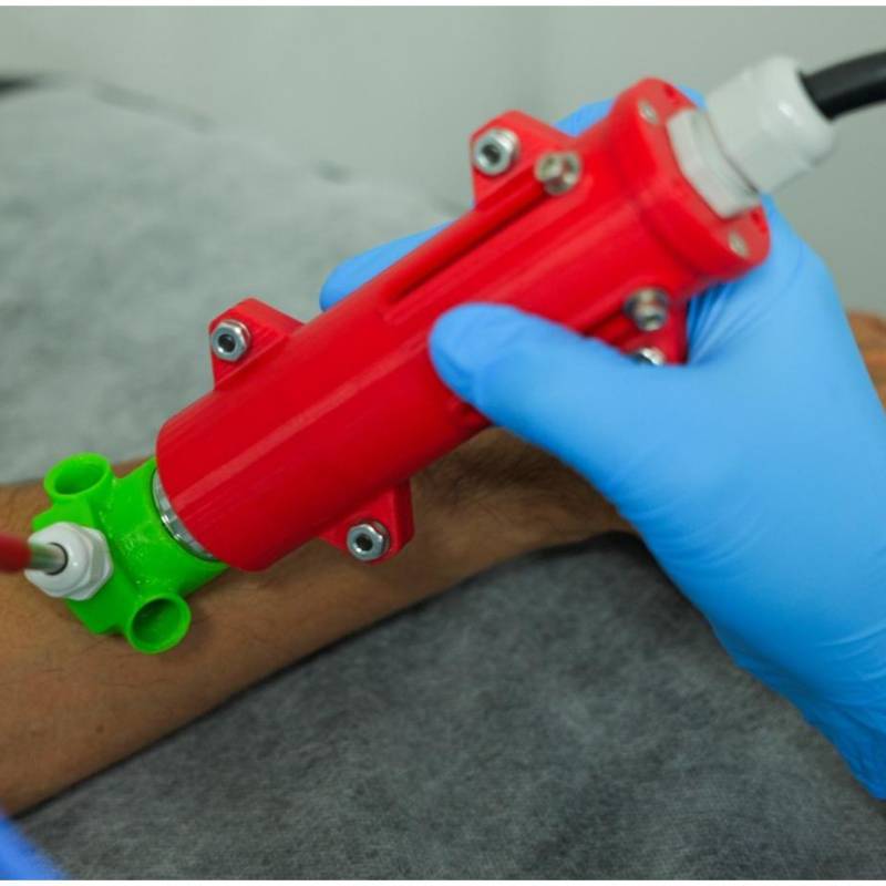 El proyecto recibió dos patentes por la Superintendencia de Industria y Comercio, una de invención y otra de modelo de utilidad. FOTO: Cortesía