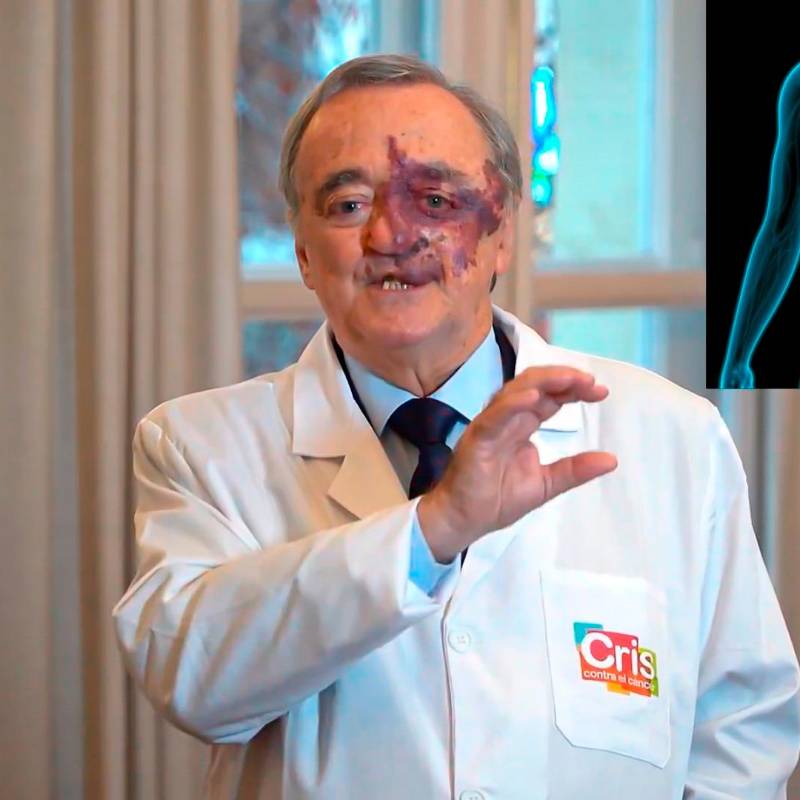 El estudio fue realizado por el Grupo de Oncología Experimental del Centro Nacional de Investigaciones Oncológicas (CNIO) de España. Foto captura de video y Depositphotos.