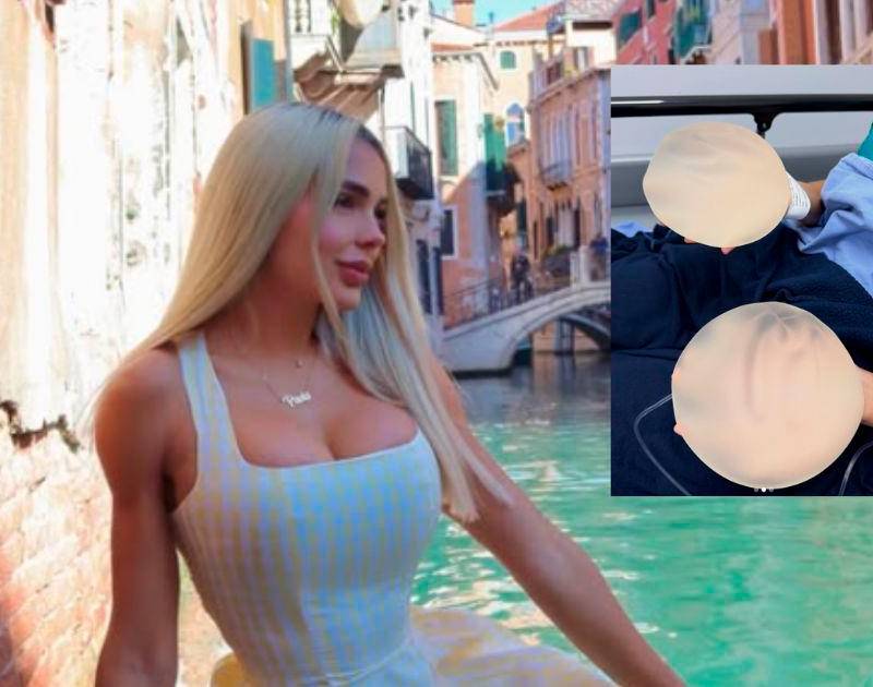 Paola Usme sorprendió a sus seguidores: se retiró los implantes